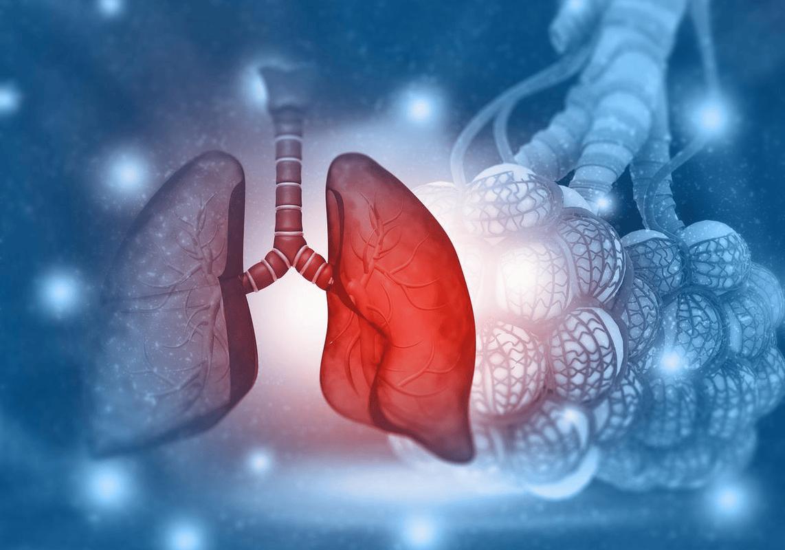 维生素B3慢阻肺治疗_维生素b3食物_慢阻肺维生素B3研究